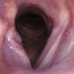 Paralysie Larynx Chien